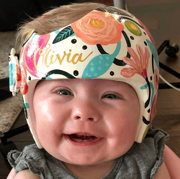baby wearing a corrective helment