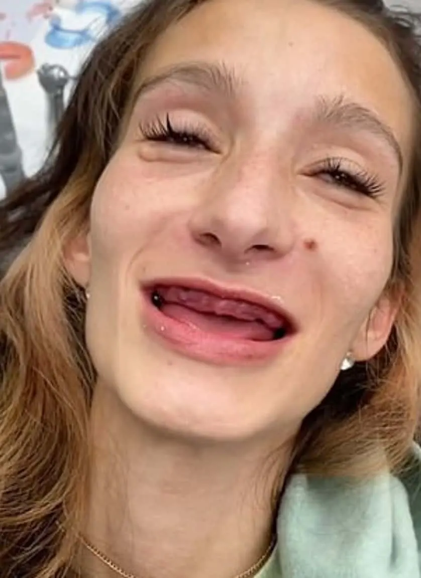 Woman Who Had Teeth Pulled Out And Leaving Her Unable To Eat Cries As She Gets Stunning Smile