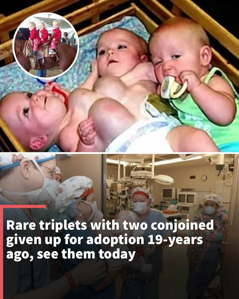 Rare triplets with two conjoined given up for adoption 19-years ago, see them today