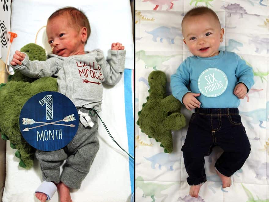 A side-by-side photo of Ryan showing him at one month old and six months old