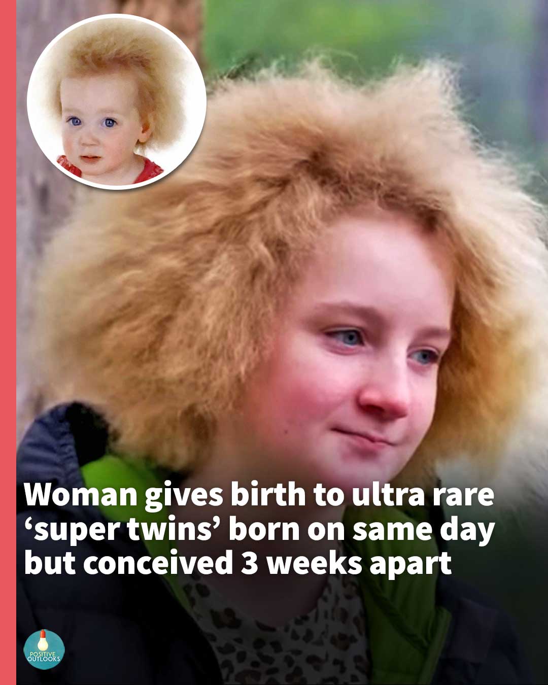 Young girl learns to love her hair syndrome