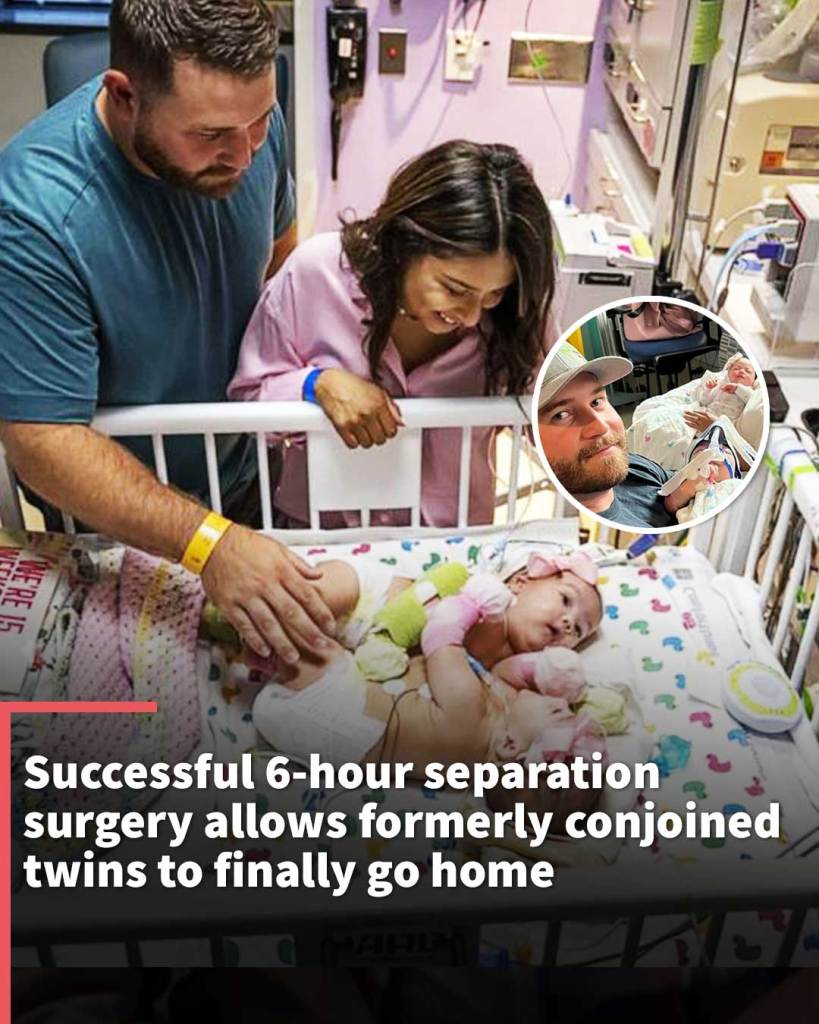 Successful 6-hour separation surgery allows formerly conjoined twins to finally go home